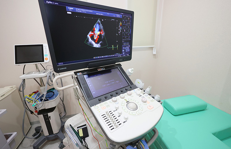 超音波診断装置（エコー）