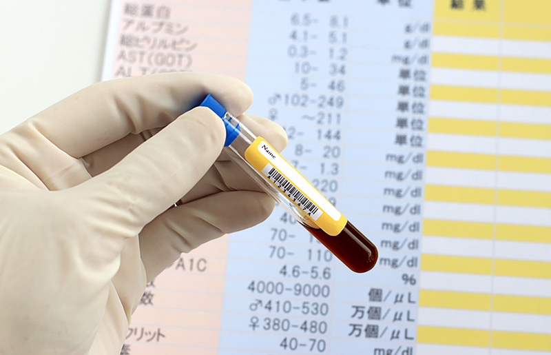 BNP/NT-proBNPとは（検査値の意味）