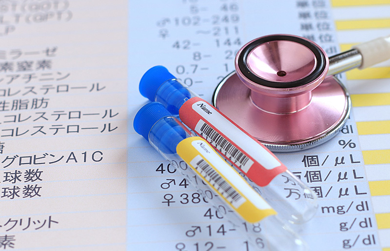 生化学検査（院内迅速検査）
