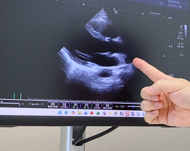 自分で行う 運動との違い